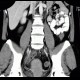Acute appendicitis, pelvic position: CT - Computed tomography